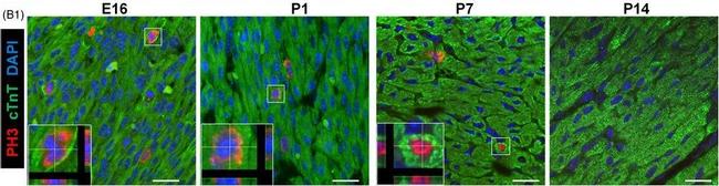 Mouse IgG (H+L) Highly Cross-Adsorbed Secondary Antibody in Immunohistochemistry (Paraffin) (IHC (P))