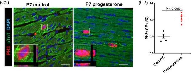 Mouse IgG (H+L) Highly Cross-Adsorbed Secondary Antibody in Immunohistochemistry (Paraffin) (IHC (P))