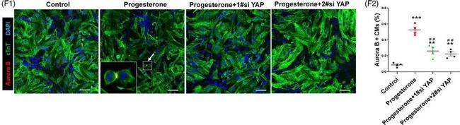 Mouse IgG (H+L) Highly Cross-Adsorbed Secondary Antibody in Immunocytochemistry (ICC/IF)