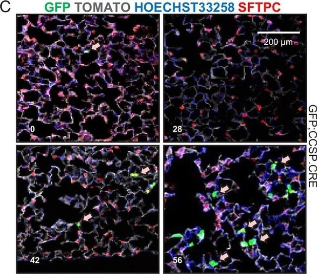 Rabbit IgG (H+L) Highly Cross-Adsorbed Secondary Antibody in Immunohistochemistry (Paraffin) (IHC (P))