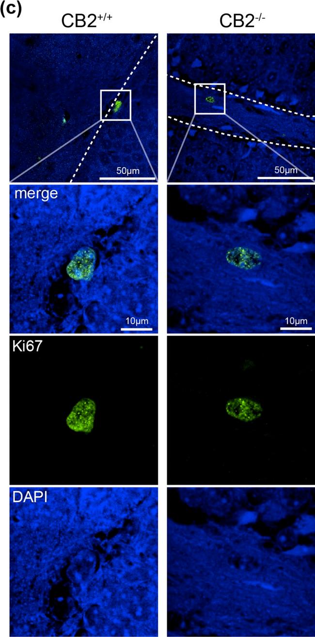 Rabbit IgG (H+L) Cross-Adsorbed Secondary Antibody in Immunohistochemistry (IHC)