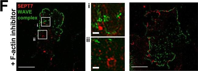 Rabbit IgG (H+L) Cross-Adsorbed Secondary Antibody in Immunocytochemistry (ICC/IF)