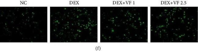 Mouse IgG1 Cross-Adsorbed Secondary Antibody in Immunohistochemistry (IHC)