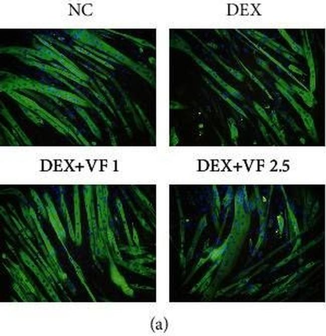 Mouse IgG1 Cross-Adsorbed Secondary Antibody in Immunohistochemistry (IHC)