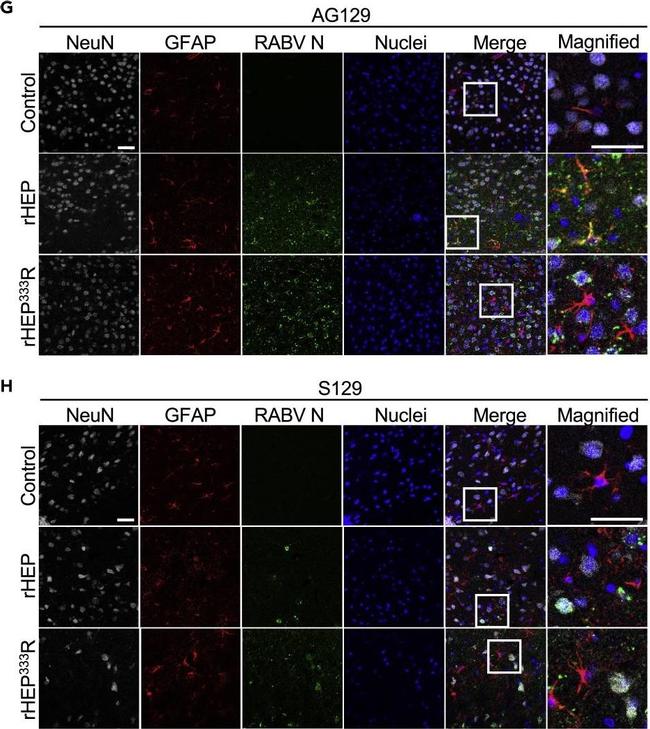 Rabbit IgG (H+L) Highly Cross-Adsorbed Secondary Antibody in Immunohistochemistry (Paraffin) (IHC (P))