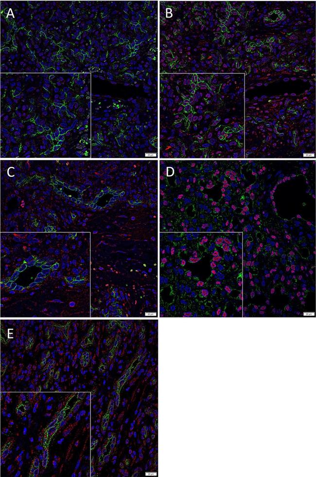 Rabbit IgG (H+L) Highly Cross-Adsorbed Secondary Antibody in Immunohistochemistry (Paraffin) (IHC (P))