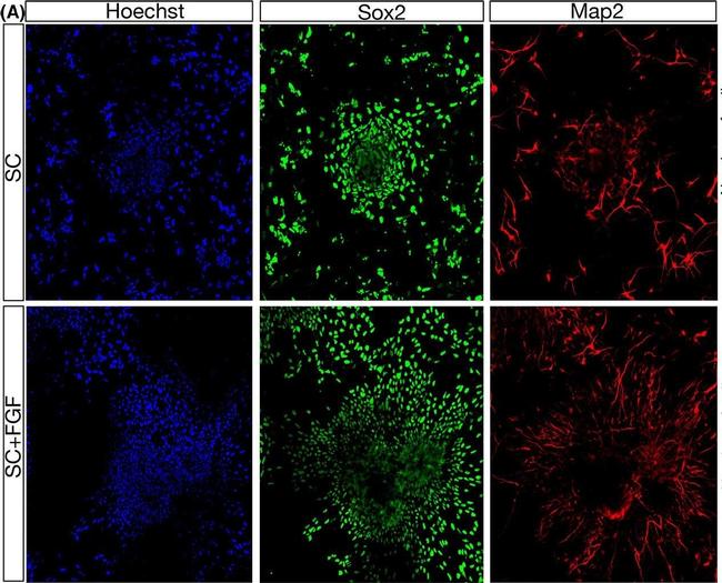 Rabbit IgG (H+L) Highly Cross-Adsorbed Secondary Antibody in Immunocytochemistry (ICC/IF)