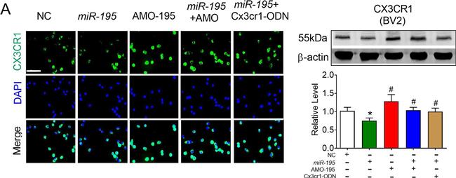 Rabbit IgG (H+L) Highly Cross-Adsorbed Secondary Antibody in Immunocytochemistry (ICC/IF)