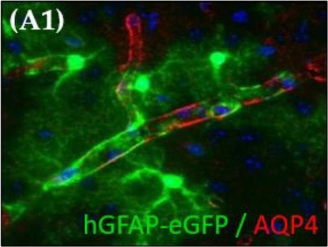 Rabbit IgG (H+L) Highly Cross-Adsorbed Secondary Antibody in Immunohistochemistry (IHC)