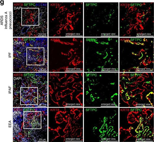 Rabbit IgG (H+L) Highly Cross-Adsorbed Secondary Antibody in Immunohistochemistry (IHC)