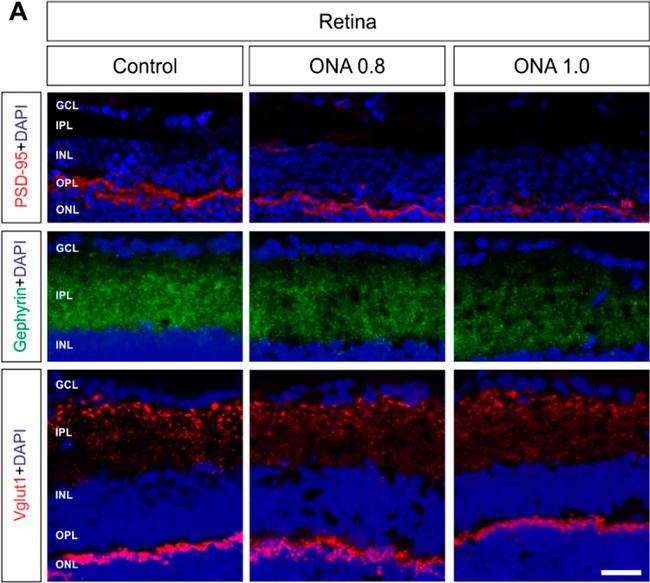 Mouse IgG (H+L) Highly Cross-Adsorbed Secondary Antibody in Immunohistochemistry (PFA fixed) (IHC (PFA))