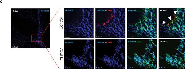 Rabbit IgG (H+L) Highly Cross-Adsorbed Secondary Antibody in Immunocytochemistry (ICC/IF)