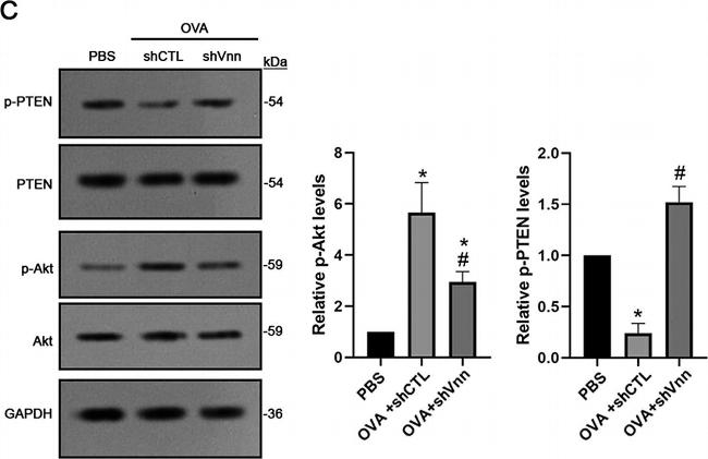 Rabbit IgG (H+L) Cross-Adsorbed Secondary Antibody in Western Blot (WB)