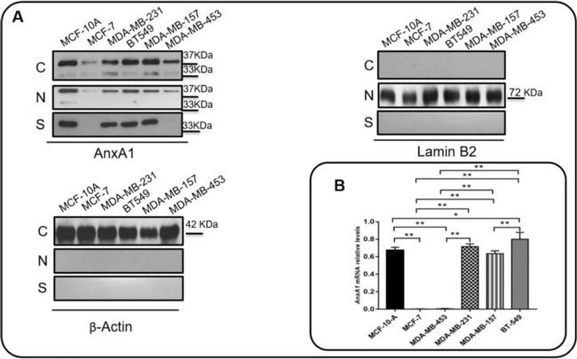 Rabbit IgG (H+L) Cross-Adsorbed Secondary Antibody in Western Blot (WB)