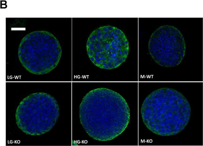 Mouse IgG (H+L) Highly Cross-Adsorbed Secondary Antibody in Immunocytochemistry (ICC/IF)