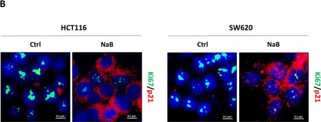 Mouse IgG (H+L) Highly Cross-Adsorbed Secondary Antibody in Immunocytochemistry (ICC/IF)