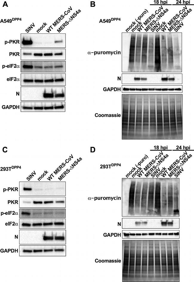 Mouse IgG (H+L) Secondary Antibody in Western Blot (WB)