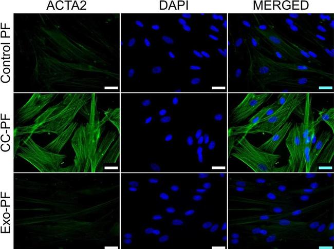 Rabbit IgG (H+L) Cross-Adsorbed Secondary Antibody in Immunocytochemistry (ICC/IF)