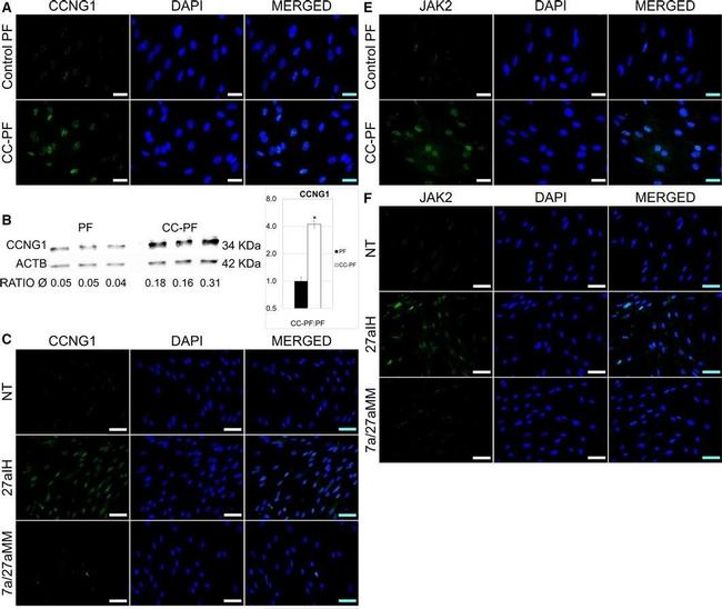 Rabbit IgG (H+L) Cross-Adsorbed Secondary Antibody in Immunocytochemistry (ICC/IF)