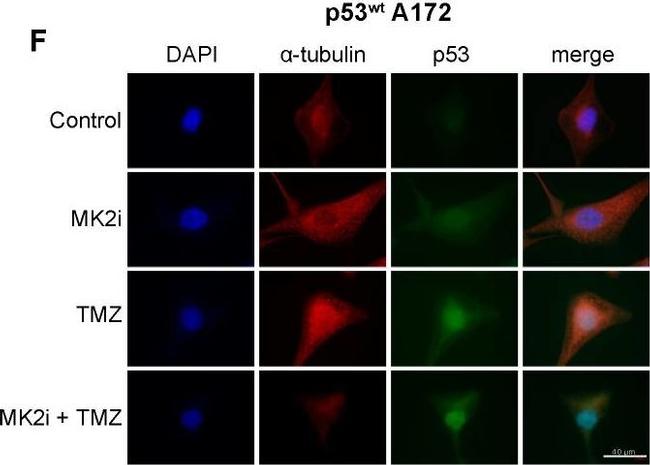 Rabbit IgG (H+L) Cross-Adsorbed Secondary Antibody in Immunocytochemistry (ICC/IF)