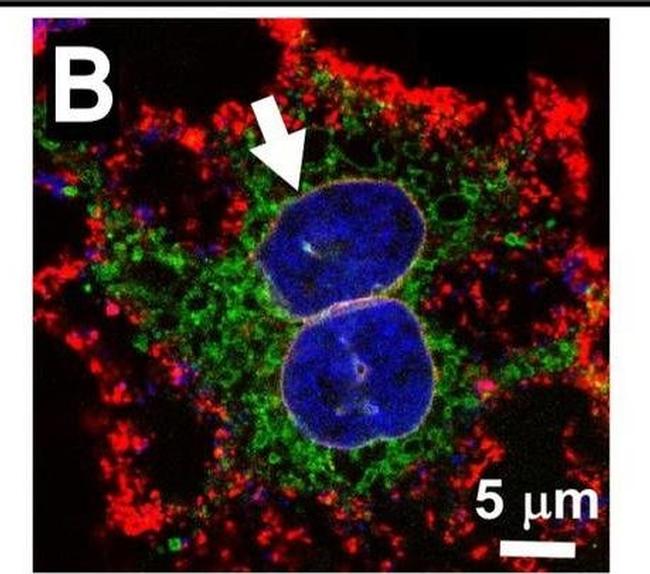 Rabbit IgG (H+L) Cross-Adsorbed Secondary Antibody in Immunocytochemistry (ICC/IF)