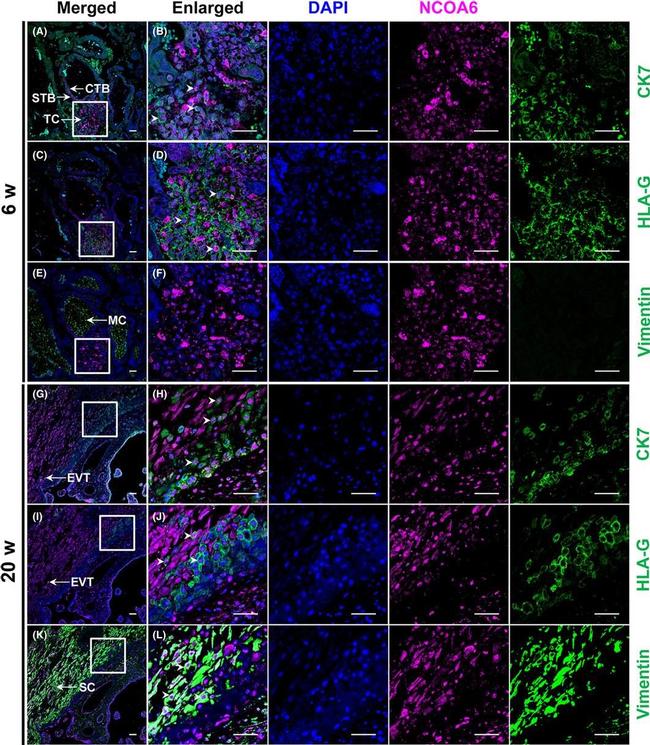 Rabbit IgG (H+L) Highly Cross-Adsorbed Secondary Antibody in Immunohistochemistry (Paraffin) (IHC (P))