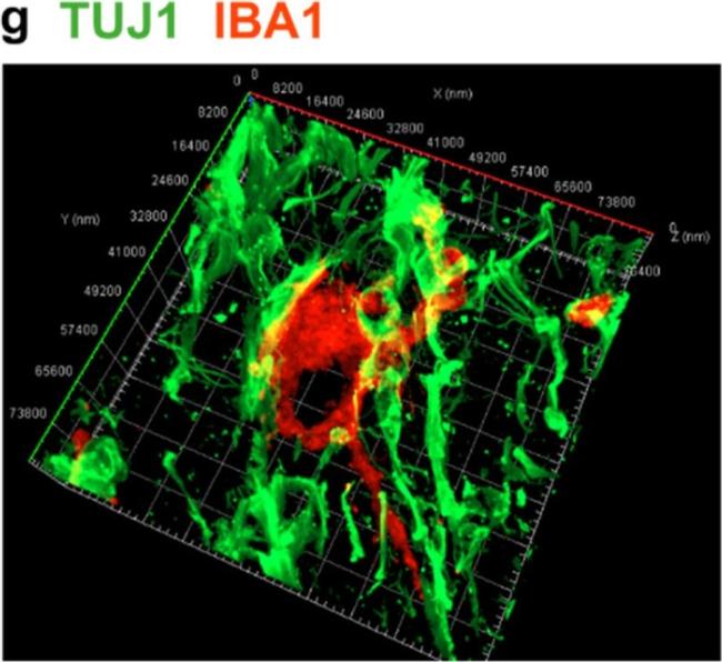 Mouse IgG (H+L) Cross-Adsorbed Secondary Antibody in Immunocytochemistry (ICC/IF)