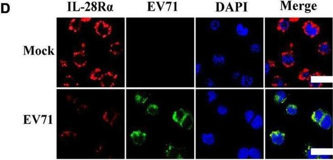 Rabbit IgG (H+L) Cross-Adsorbed Secondary Antibody in Immunocytochemistry (ICC/IF)