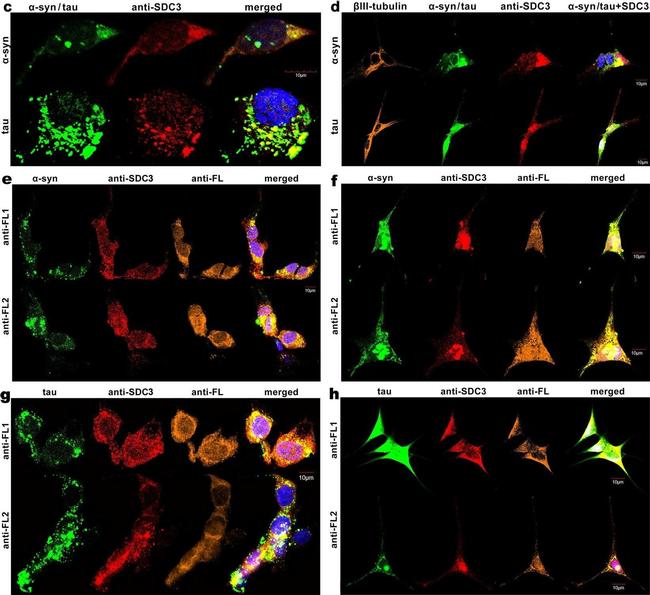 Mouse IgG (H+L) Cross-Adsorbed Secondary Antibody in Immunocytochemistry (ICC/IF)