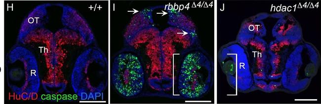 Mouse IgG (H+L) Cross-Adsorbed Secondary Antibody in Immunohistochemistry (Paraffin) (IHC (P))