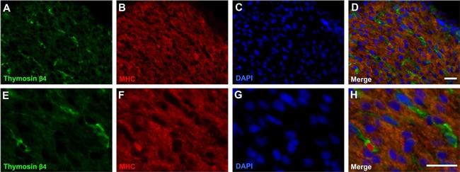 Mouse IgG (H+L) Cross-Adsorbed Secondary Antibody in Immunohistochemistry (Paraffin) (IHC (P))