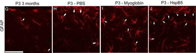 Mouse IgG (H+L) Cross-Adsorbed Secondary Antibody in Immunocytochemistry (ICC/IF)