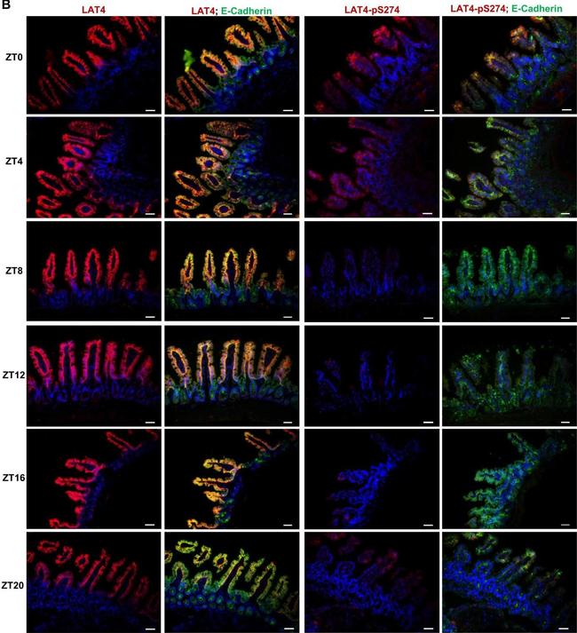 Rat IgG (H+L) Cross-Adsorbed Secondary Antibody in Immunohistochemistry (IHC)