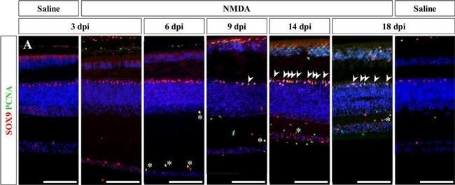 Rabbit IgG (H+L) Cross-Adsorbed Secondary Antibody in Immunohistochemistry (Paraffin) (IHC (P))