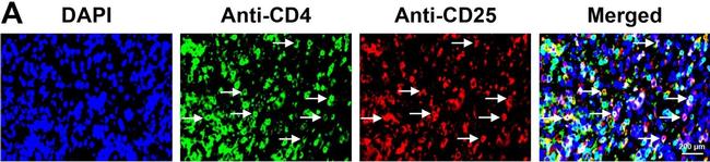 Mouse IgG (H+L) Highly Cross-Adsorbed Secondary Antibody in Immunohistochemistry (Paraffin) (IHC (P))