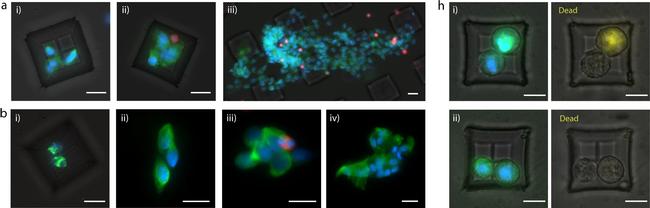 Rabbit IgG (H+L) Cross-Adsorbed Secondary Antibody in Immunocytochemistry (ICC/IF)