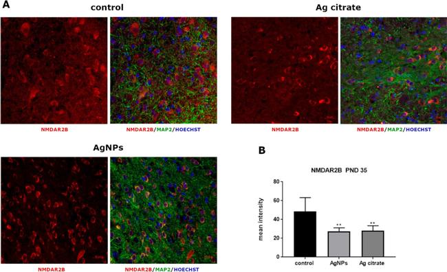 Mouse IgG1 Cross-Adsorbed Secondary Antibody in Immunohistochemistry (IHC)