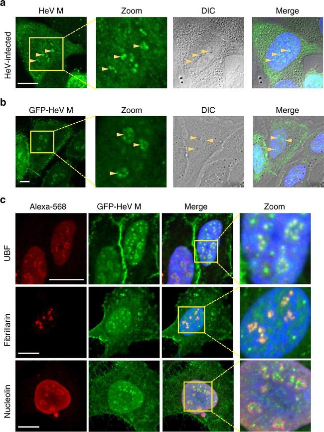 Rabbit IgG (H+L) Cross-Adsorbed Secondary Antibody in Immunocytochemistry (ICC/IF)