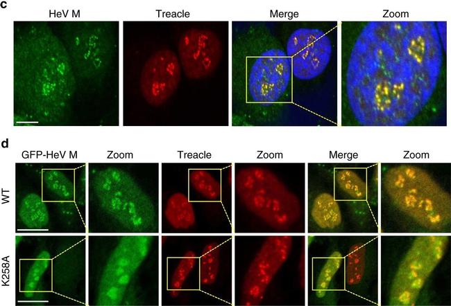 Rabbit IgG (H+L) Highly Cross-Adsorbed Secondary Antibody in Immunocytochemistry (ICC/IF)