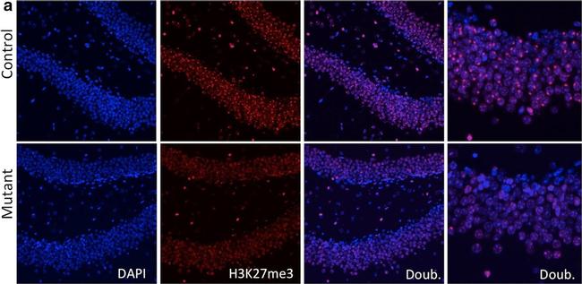 Rabbit IgG (H+L) Cross-Adsorbed Secondary Antibody in Immunohistochemistry (Paraffin) (IHC (P))