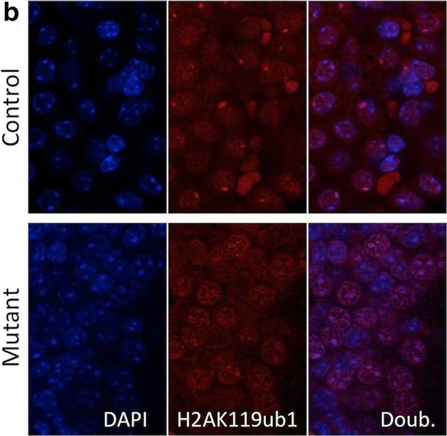 Rabbit IgG (H+L) Cross-Adsorbed Secondary Antibody in Immunohistochemistry (Paraffin) (IHC (P))