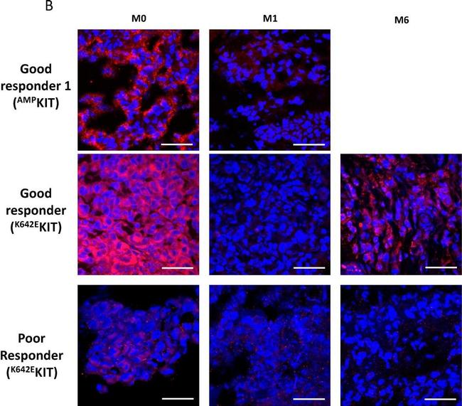 Rabbit IgG (H+L) Cross-Adsorbed Secondary Antibody in Immunohistochemistry (Frozen) (IHC (F))