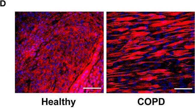 Rabbit IgG (H+L) Cross-Adsorbed Secondary Antibody in Immunocytochemistry (ICC/IF)