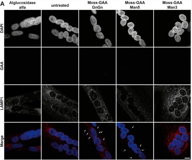 Rabbit IgG (H+L) Cross-Adsorbed Secondary Antibody in Immunocytochemistry (ICC/IF)