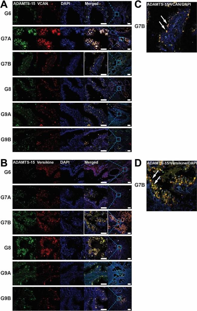 Rabbit IgG (H+L) Cross-Adsorbed Secondary Antibody in Immunohistochemistry (Paraffin) (IHC (P))