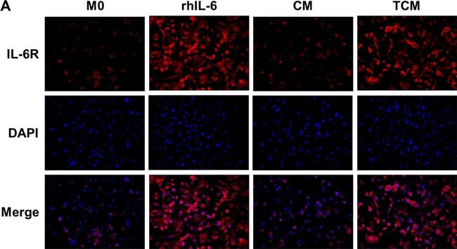 Rabbit IgG (H+L) Cross-Adsorbed Secondary Antibody in Immunocytochemistry (ICC/IF)