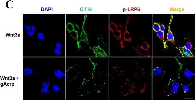 Rabbit IgG (H+L) Cross-Adsorbed Secondary Antibody in Immunocytochemistry (ICC/IF)