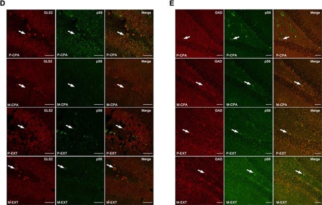 Rabbit IgG (H+L) Highly Cross-Adsorbed Secondary Antibody in Immunohistochemistry (IHC)