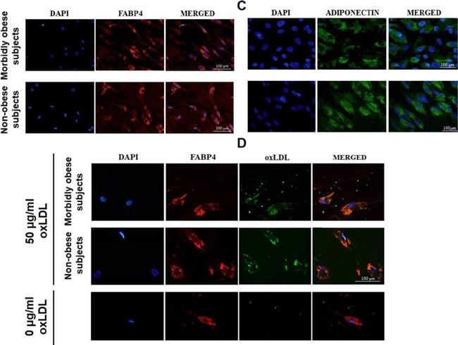 Mouse IgG (H+L) Highly Cross-Adsorbed Secondary Antibody in Immunocytochemistry (ICC/IF)