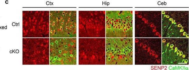 Rabbit IgG (H+L) Highly Cross-Adsorbed Secondary Antibody in Immunohistochemistry (PFA fixed) (IHC (PFA))